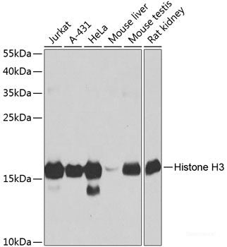 Immunofluorescence analysis of HeLa cells using LAMP1 Polyclonal Antibody at dilution of  1:100. Blue: DAPI for nuclear staining.