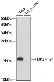Immunohistochemistry of paraffin-embedded Rat heart using SDHA Polyclonal Antibody at dilution of  1:100 (40x lens).