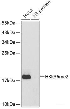 Immunohistochemistry of paraffin-embedded Rat brain using NRG4 Polyclonal Antibody at dilution of  1:100 (40x lens).