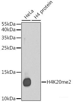 Immunohistochemistry of paraffin-embedded Human liver damage using MAT1A Polyclonal Antibody at dilution of  1:100 (40x lens).