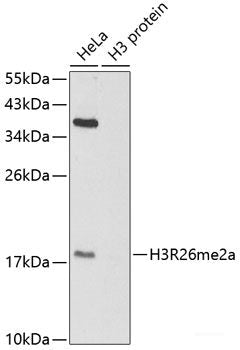 Immunohistochemistry of paraffin-embedded Mouse heart using COX6B1 Polyclonal Antibody at dilution of  1:100 (40x lens).