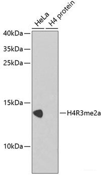 Immunohistochemistry of paraffin-embedded Human liver damage using ABCB8 Polyclonal Antibody at dilution of  1:100 (40x lens).
