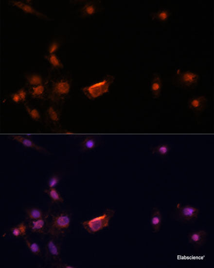 Immunohistochemistry of paraffin-embedded Human stomach using DBH Polyclonal Antibody at dilution of  1:100 (40x lens).