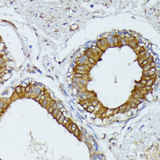 Immunohistochemistry of paraffin-embedded Rat heart using TRAP1 Polyclonal Antibody at dilution of  1:100 (40x lens).