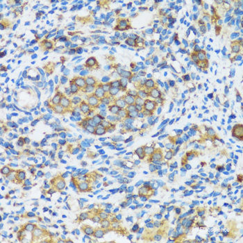 Immunohistochemistry of paraffin-embedded Rat heart using PTPN11 Polyclonal Antibody at dilution of  1:100 (40x lens).