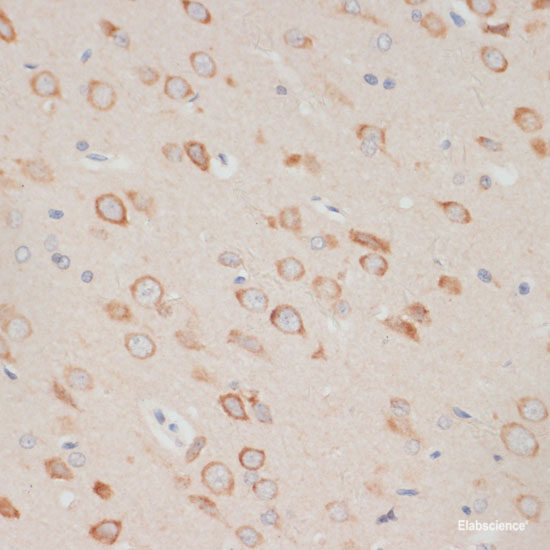 Immunohistochemistry of paraffin-embedded Human lung using APC Polyclonal Antibody at dilution of  1:200 (40x lens).