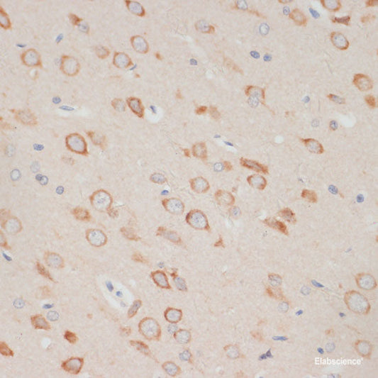 Immunohistochemistry of paraffin-embedded Human lung using APC Polyclonal Antibody at dilution of  1:200 (40x lens).