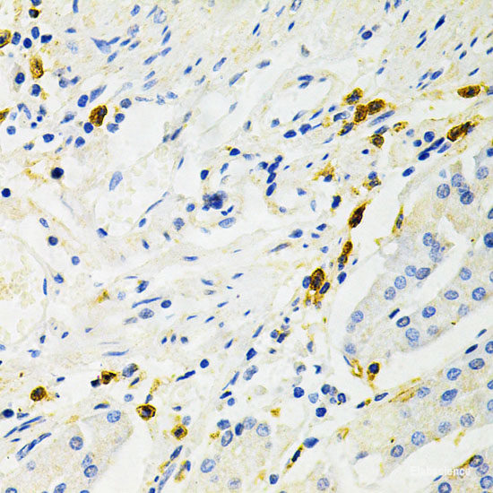 Immunofluorescence analysis of Rat brain using SLC1A1 Polyclonal Antibody at dilution of  1:100. Blue: DAPI for nuclear staining.