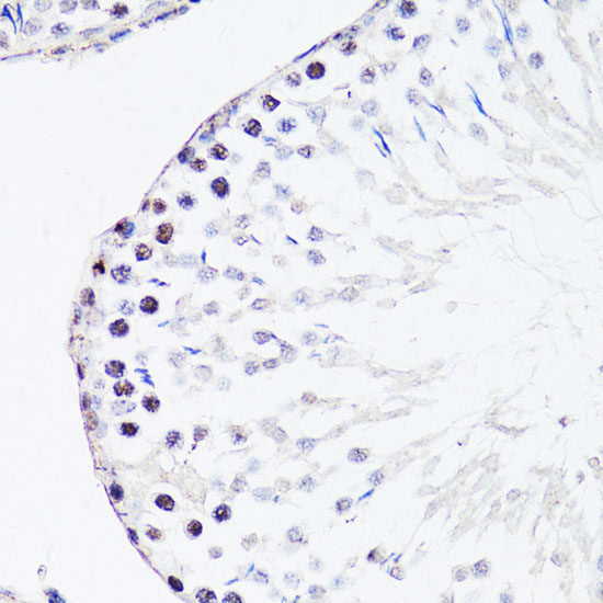 Immunohistochemistry of paraffin-embedded Rat brain using NFkB p100 / p52 Polyclonal Antibody at dilution of  1:100 (40x lens).