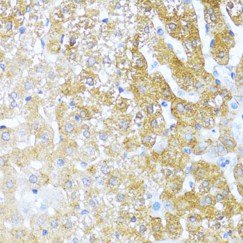 Immunohistochemistry of paraffin-embedded Human esophagus using NTF3 Polyclonal Antibody at dilution of  1:100 (40x lens).