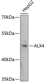 Western blot analysis of extracts of various cell lines using NLK Polyclonal Antibody at dilution of 1:1000.