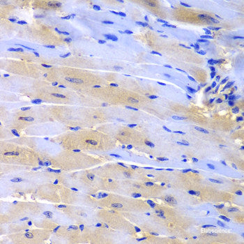 Immunohistochemistry of paraffin-embedded Human stomach using CAMK2G Polyclonal Antibody at dilution of  1:100 (40x lens).
