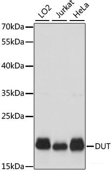 Immunohistochemistry of paraffin-embedded Rat spleen using PAK1 Polyclonal Antibody at dilution of  1:100 (40x lens).
