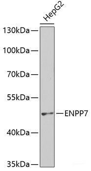 Western blot analysis of extracts of Mouse liver using EPHB4 Polyclonal Antibody at dilution of 1:1000.
