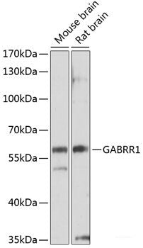 Immunohistochemistry of paraffin-embedded Rat testis using KIFC1 Polyclonal Antibody at dilution of  1:100 (40x lens).