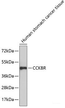 Immunofluorescence analysis of C6 cells using MAP1B Polyclonal Antibody at dilution of  1:100. Blue: DAPI for nuclear staining.