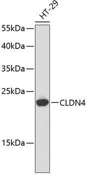 Immunofluorescence analysis of HeLa cells using ALDH6A1 Polyclonal Antibody at dilution of  1:100. Blue: DAPI for nuclear staining.