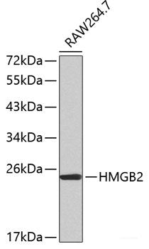 Immunohistochemistry of paraffin-embedded Human lung cancer using LRPPRC Polyclonal Antibody at dilution of  1:100 (40x lens).
