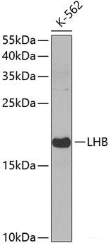 Immunofluorescence analysis of C6 cells using NSUN2 Polyclonal Antibody at dilution of  1:100. Blue: DAPI for nuclear staining.