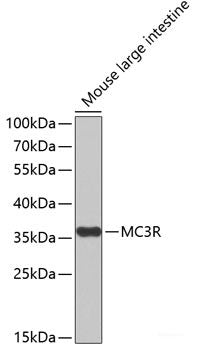Immunohistochemistry of paraffin-embedded Human colon carcinoma using SLC39A4 Polyclonal Antibody at dilution of  1:100 (40x lens).