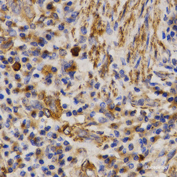 Immunohistochemistry of paraffin-embedded Human stomach using CCT6A Polyclonal Antibody at dilution of  1:100 (40x lens).