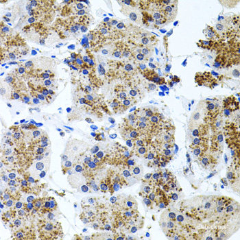 Immunohistochemistry of paraffin-embedded Mouse brain using CD97 Polyclonal Antibody at dilution of  1:100 (40x lens).