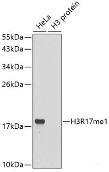 Immunohistochemistry of paraffin-embedded Human liver damage using CETN1 Polyclonal Antibody at dilution of  1:100 (40x lens).