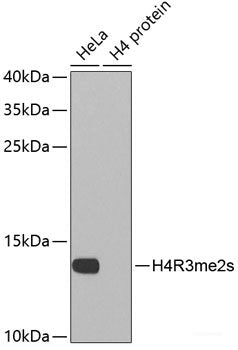 Immunohistochemistry of paraffin-embedded Rat brain using CRYM Polyclonal Antibody at dilution of  1:100 (40x lens).