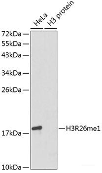 Immunohistochemistry of paraffin-embedded Human colon carcinoma using DACH1 Polyclonal Antibody at dilution of  1:100 (40x lens).