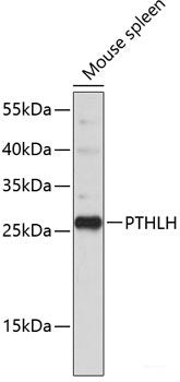 Immunohistochemistry of paraffin-embedded Human liver cancer using FDXR Polyclonal Antibody at dilution of  1:100 (40x lens).