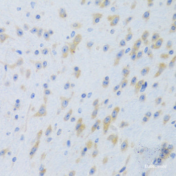Immunohistochemistry of paraffin-embedded Human colon using FKBP5 Polyclonal Antibody at dilution of  1:100 (40x lens).