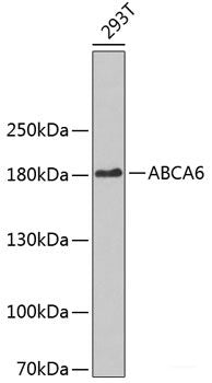 Immunohistochemistry of paraffin-embedded Human liver damage using GFPT1 Polyclonal Antibody at dilution of  1:100 (40x lens).