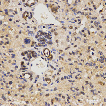Immunohistochemistry of paraffin-embedded Human stomach using GLS Polyclonal Antibody at dilution of  1:100 (40x lens).