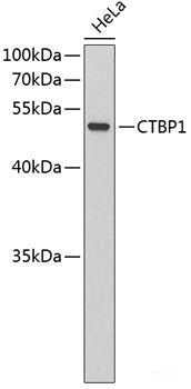 Immunofluorescence analysis of HeLa cells using MOV10 Polyclonal Antibody at dilution of  1:100. Blue: DAPI for nuclear staining.