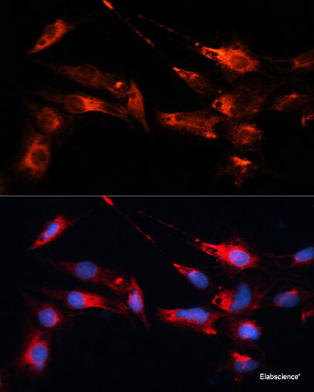 Immunofluorescence analysis of HeLa cells using PSMB6 Polyclonal Antibody at dilution of  1:100 (40x lens). Blue: DAPI for nuclear staining.