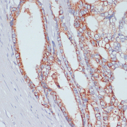 Immunohistochemistry of paraffin-embedded Mouse liver using ARHGEF5 Polyclonal Antibody at dilution of  1:100 (40x lens).