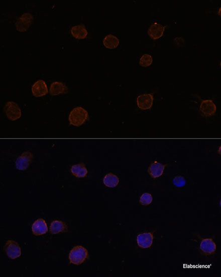 Immunohistochemistry of paraffin-embedded Human prostate using SAFB2 Polyclonal Antibody at dilution of  1:100 (40x lens).