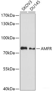 Immunohistochemistry of paraffin-embedded Rat testis using DDX46 Polyclonal Antibody at dilution of  1:100 (40x lens).