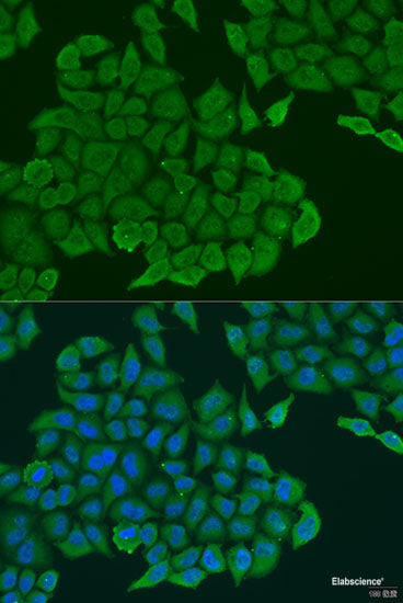 Immunohistochemistry of paraffin-embedded Mouse lung using ABCF2 Polyclonal Antibody at dilution of  1:100 (40x lens).
