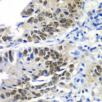 Immunofluorescence analysis of U2OS cells using ADAP1 Polyclonal Antibody at dilution of  1:100. Blue: DAPI for nuclear staining.