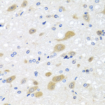 Immunohistochemistry of paraffin-embedded Human esophagus using TMOD3 Polyclonal Antibody at dilution of  1:100 (40x lens).