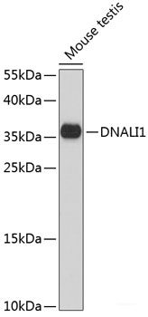 Western blot analysis of extracts of various cell lines using ACY3 Polyclonal Antibody at dilution of 1:3000.