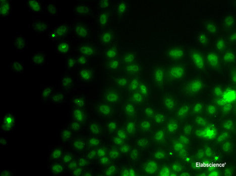 Immunofluorescence analysis of U2OS cells using ASH2L Polyclonal Antibody