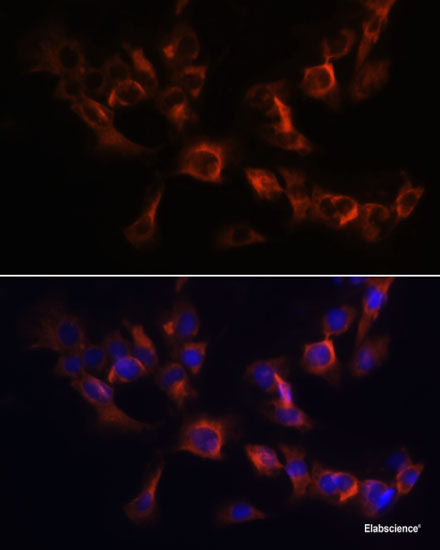 Immunohistochemistry of paraffin-embedded Rat testis using KIF2C Polyclonal Antibody at dilution of  1:100 (40x lens).
