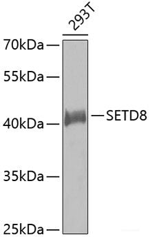 Immunohistochemistry of paraffin-embedded Human thyroid cancer using FHL1 Polyclonal Antibody at dilution of  1:100 (40x lens).