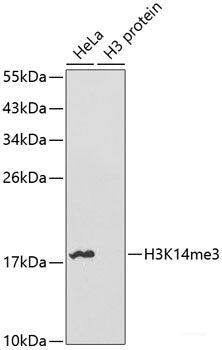 Immunohistochemistry of paraffin-embedded Human gastric cancer using PFKM Polyclonal Antibody at dilution of  1:100 (40x lens).