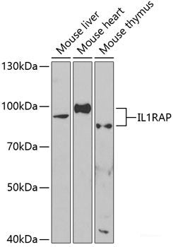 Immunohistochemistry of paraffin-embedded Human kidney cancer using UGT1A4 Polyclonal Antibody at dilution of  1:200 (40x lens).