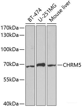 Immunohistochemistry of paraffin-embedded Human liver using STX1A Polyclonal Antibody at dilution of  1:100 (40x lens).