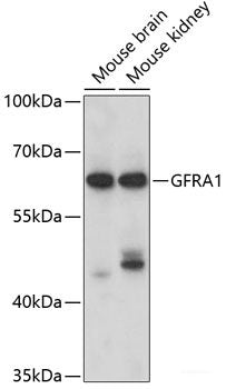 Immunohistochemistry of paraffin-embedded Human breast cancer using SKIV2L2 Polyclonal Antibody at dilution of  1:100 (40x lens).