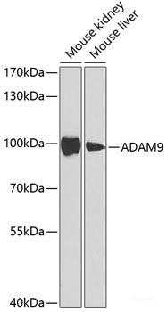 Immunohistochemistry of paraffin-embedded Human stomach using FBXL5 Polyclonal Antibody at dilution of  1:100 (40x lens).